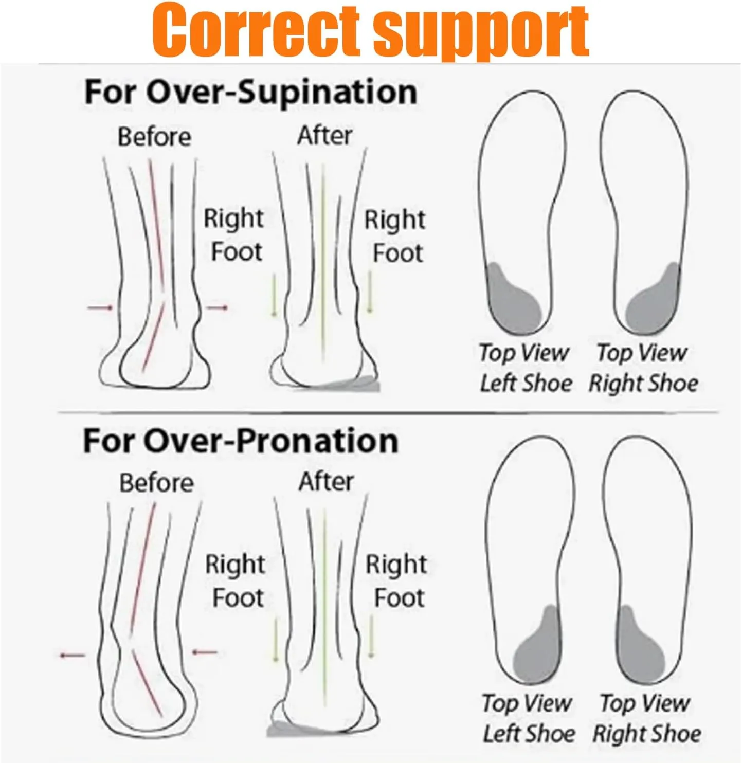 Breathable Soft Sole Mesh Comfort Orthopedic Women Sneakers,Orthopedic Shoes Slip Ons with Arch Support